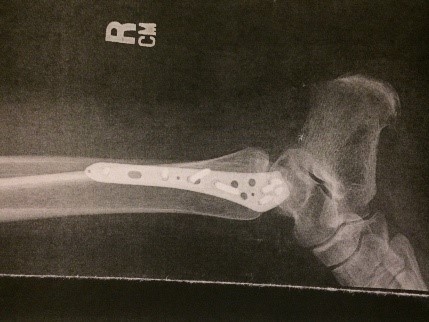 Putting all the pieces together again!