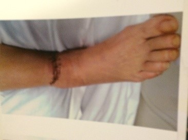 Putting all the pieces together again!